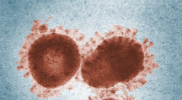microscopic shot of a virus